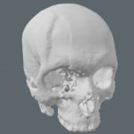 Final outer surface.