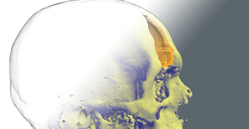 Designing a Skull Implant with Game Art Tools Header Image