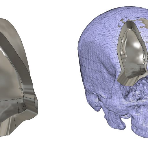 Inserting the skull and surfaces into Fusion 360.